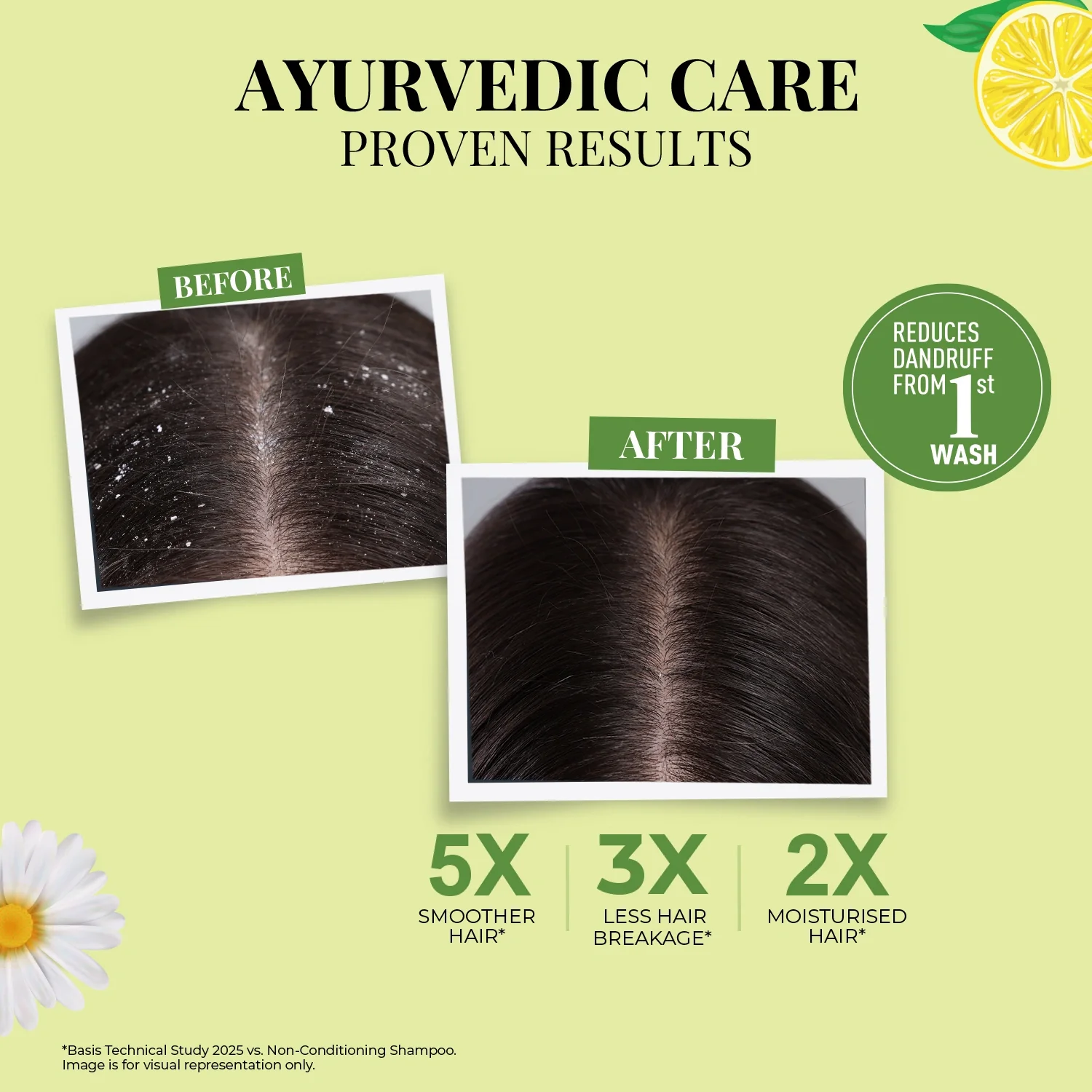 Anti Dandruff Shampoo | Lemon, Bhringraj & 12 Herbs - Image 6